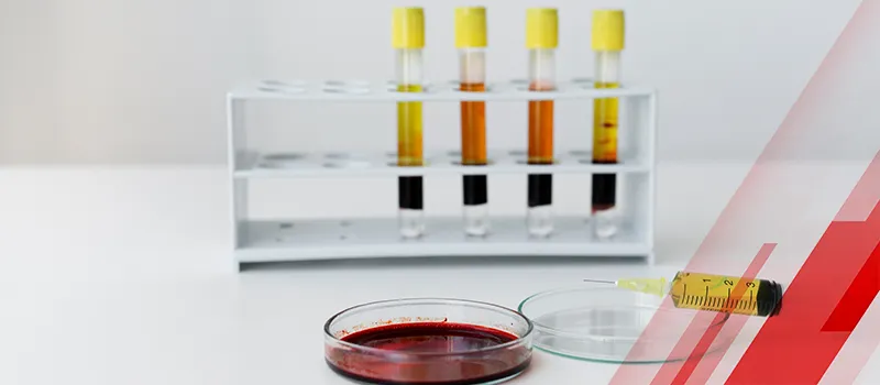 Latex Agglutination Test Kits: The Game-Changer in Medical Diagnostics